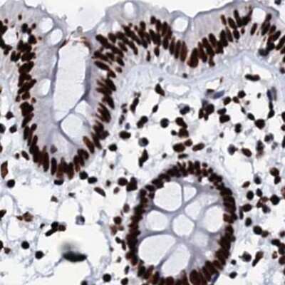Immunohistochemistry-Paraffin: RALY Antibody [NBP2-13200]