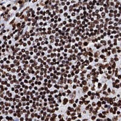 Immunohistochemistry-Paraffin: RALY Antibody [NBP2-13200]