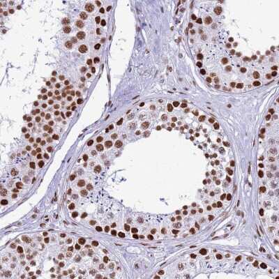 Immunohistochemistry-Paraffin: RALY Antibody [NBP2-13201]