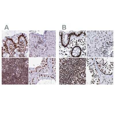 Immunohistochemistry-Paraffin: RALY Antibody [NBP2-13201]