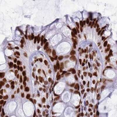 Immunohistochemistry-Paraffin: RALY Antibody [NBP2-13201]