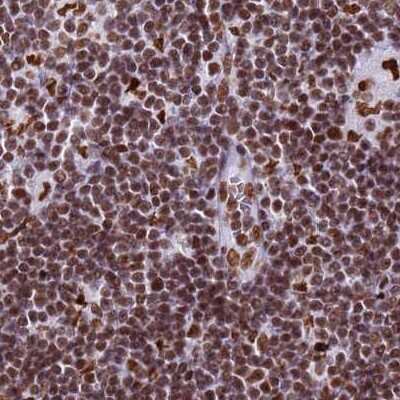 Immunohistochemistry-Paraffin: RALY Antibody [NBP2-13201]