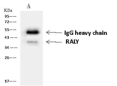 Immunoprecipitation: RALY Antibody [NBP2-97634]