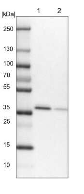 Western Blot: RALY Antibody [NBP2-13200]