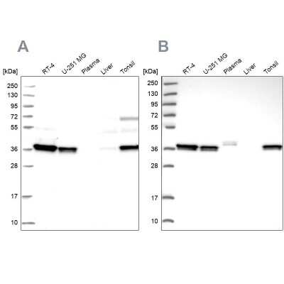 Western Blot: RALY Antibody [NBP2-13200]