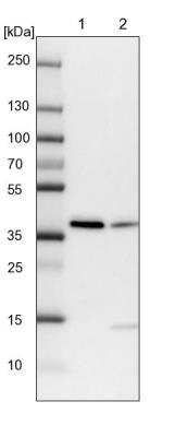 Western Blot: RALY Antibody [NBP2-13201]