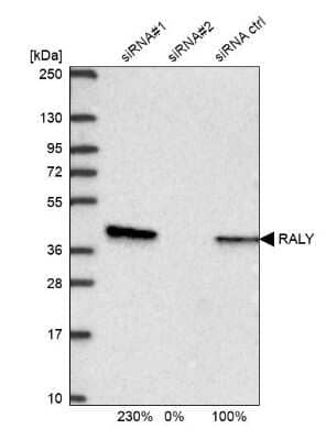 Western Blot: RALY Antibody [NBP2-13201]