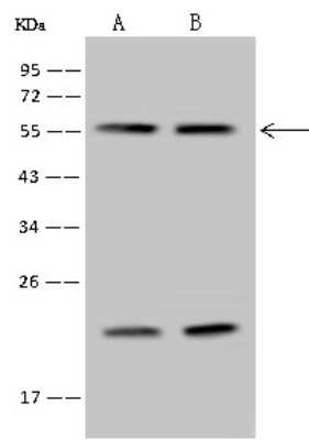 Western Blot: RALY Antibody [NBP2-97634]