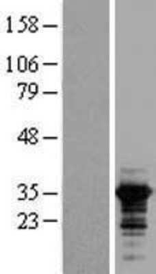 Western Blot: RALY Overexpression Lysate [NBL1-15134]