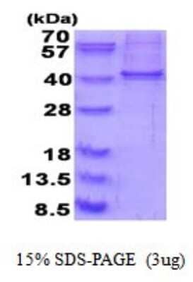 SDS-PAGE: Recombinant Human RALY His Protein [NBP2-51845]