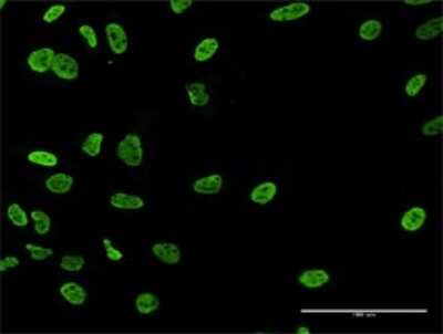Immunocytochemistry/ Immunofluorescence: RALYL Antibody [H00138046-B03P]