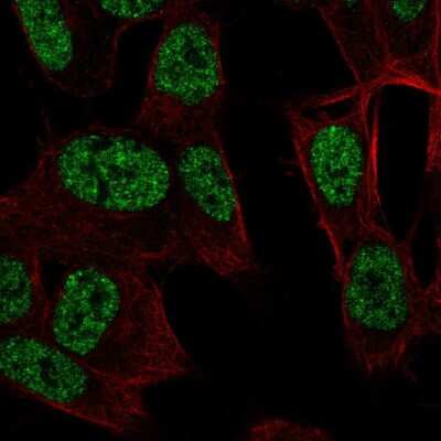 Immunocytochemistry/ Immunofluorescence: RALYL Antibody [NBP2-56158]