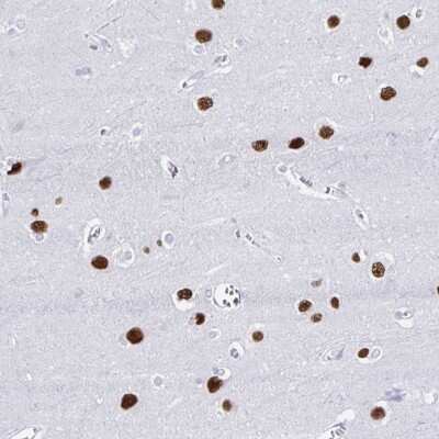 Immunohistochemistry-Paraffin: RALYL Antibody [NBP2-33768]