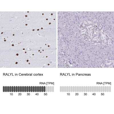 Immunohistochemistry-Paraffin: RALYL Antibody [NBP2-33768]