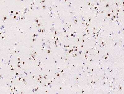 Immunohistochemistry-Paraffin: RALYL Antibody [NBP3-05925]