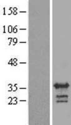 Western Blot: RALYL Overexpression Lysate [NBP2-09328]