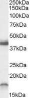 Western Blot: RAMP1 Antibody [NBP1-20966]