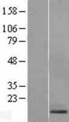 Western Blot: RAMP1 Overexpression Lysate [NBL1-15136]