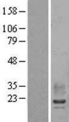 Western Blot: RAMP2 Overexpression Lysate [NBL1-15137]