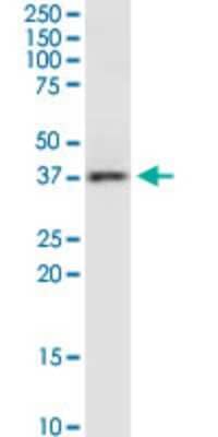 Western Blot: RAMP3 Antibody (1C11) [H00010268-M01]