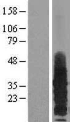 Western Blot: RAMP3 Overexpression Lysate [NBL1-15138]