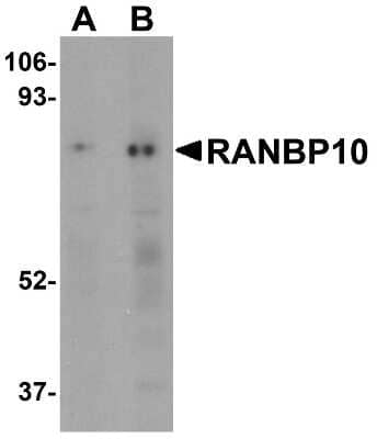 Western Blot: RANBP10 AntibodyBSA Free [NBP1-77372]