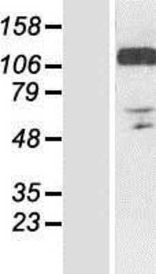 Western Blot: RANBP10 Overexpression Lysate [NBP2-06601]