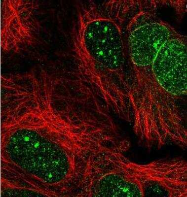 Immunocytochemistry/ Immunofluorescence: RANBP17 Antibody [NBP1-91029]