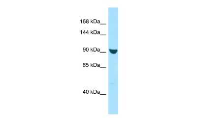 Western Blot: RANBP17 Antibody [NBP2-85592]