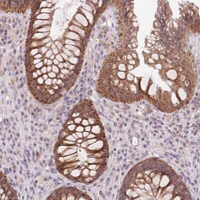 Immunohistochemistry: RANBP3L Antibody [NBP2-38929]