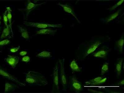 Immunocytochemistry/ Immunofluorescence: RANBP6 Antibody [H00026953-B01P]
