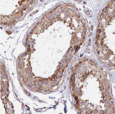 Immunohistochemistry-Paraffin: RANBP6 Antibody [NBP1-86199]