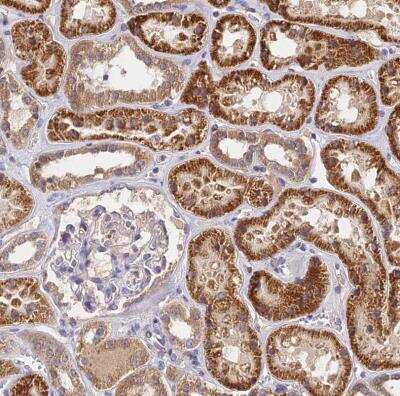 Immunohistochemistry-Paraffin: RANBP6 Antibody [NBP1-86199]