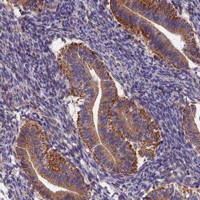 Immunohistochemistry-Paraffin: RANBP6 Antibody [NBP1-86199]