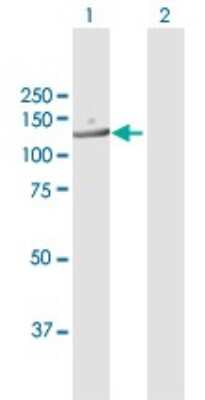 Western Blot: RANBP6 Antibody [H00026953-B01P]