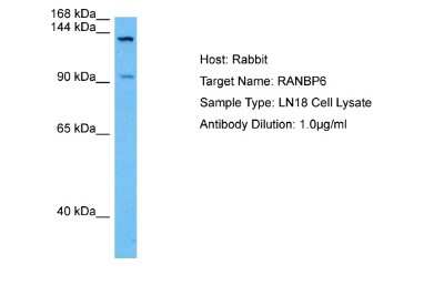 Western Blot: RANBP6 Antibody [NBP2-88123]