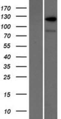 Western Blot: RANBP6 Overexpression Lysate [NBP2-07448]