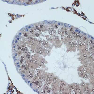Immunohistochemistry-Paraffin: RANBP9 Antibody (4P10V6) [NBP3-15702]