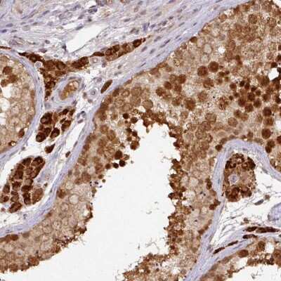 Immunohistochemistry-Paraffin: RANBP9 Antibody [NBP2-47315]