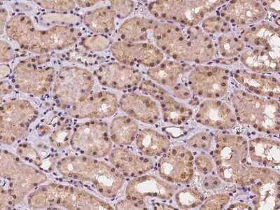 Immunohistochemistry-Paraffin: RANBP9 Antibody [NBP2-98142]