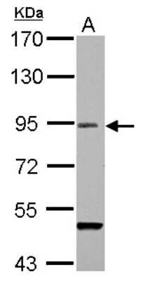 Western Blot: RANBP9 Antibody [NBP2-15087]