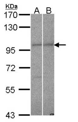 Western Blot: RANBP9 Antibody [NBP2-15087]