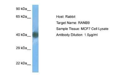 Western Blot: RANBP9 Antibody [NBP2-85593]