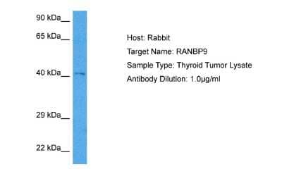 Western Blot: RANBP9 Antibody [NBP2-85595]