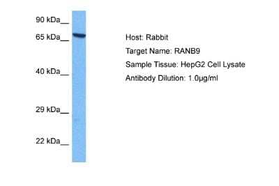 Western Blot: RANBP9 Antibody [NBP2-85596]