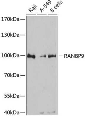 Western Blot: RANBP9 AntibodyAzide and BSA Free [NBP2-93772]