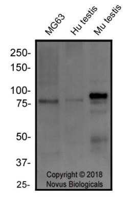 Western Blot: RANK/TNFRSF11A Antibody (64C1385.1)Azide Free [NBP2-33256]