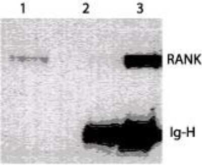Western Blot: RANK/TNFRSF11A Antibody (64C1385.1)BSA Free [NBP2-24702]