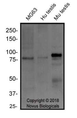 Western Blot: RANK/TNFRSF11A Antibody (64C1385.1)BSA Free [NBP2-24702]