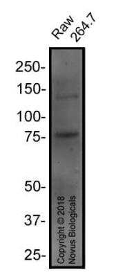Western Blot: RANK/TNFRSF11A Antibody (64C1385.1)BSA Free [NBP2-24702]